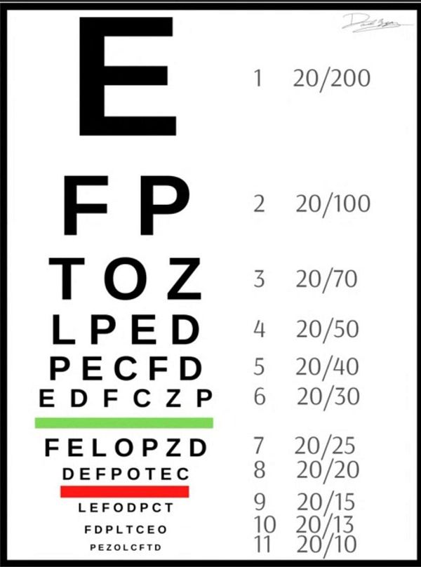 An eye chart displaying various letters and visual acuity measurements.