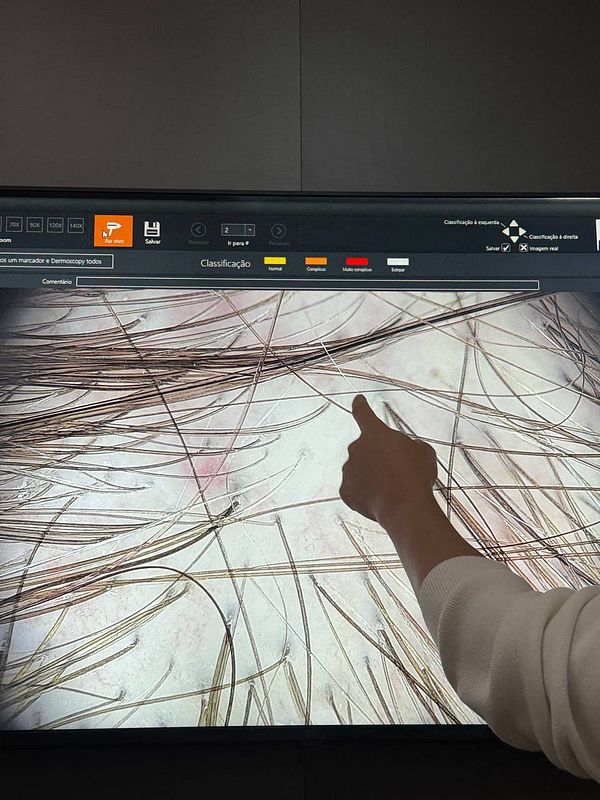 A close-up view of hair strands on a digital screen with a hand pointing at them.