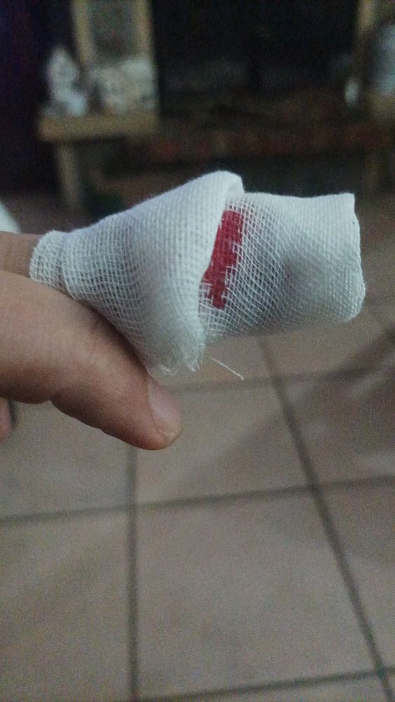 A kitchen countertop with a slicing board featuring sliced tomatoes, a hand with a bandaged index finger, and a wired mouse nearby.