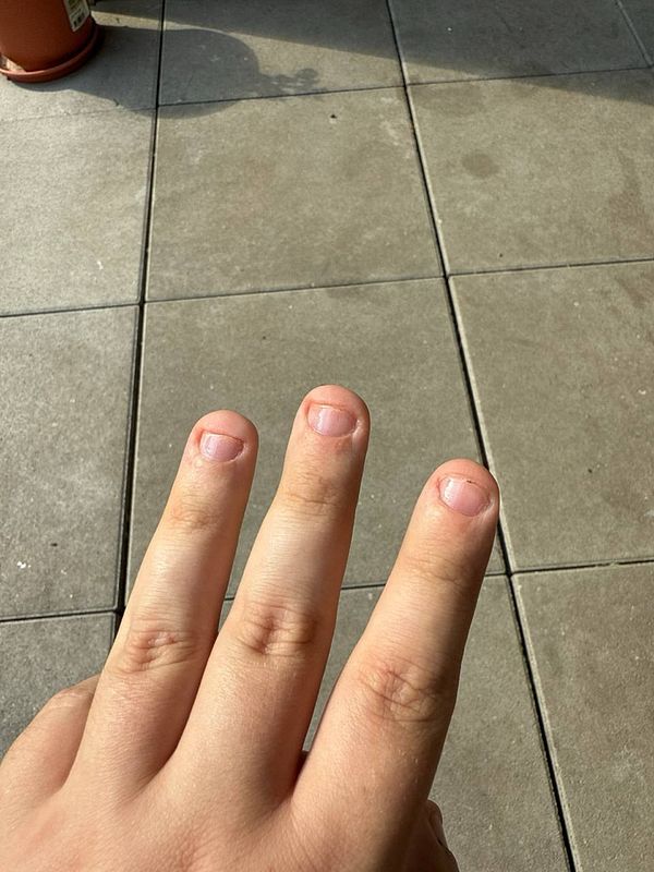 A hand with four fingers displayed, showing short, unpolished nails against a tiled surface.