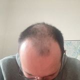 Bold-AI-Builder