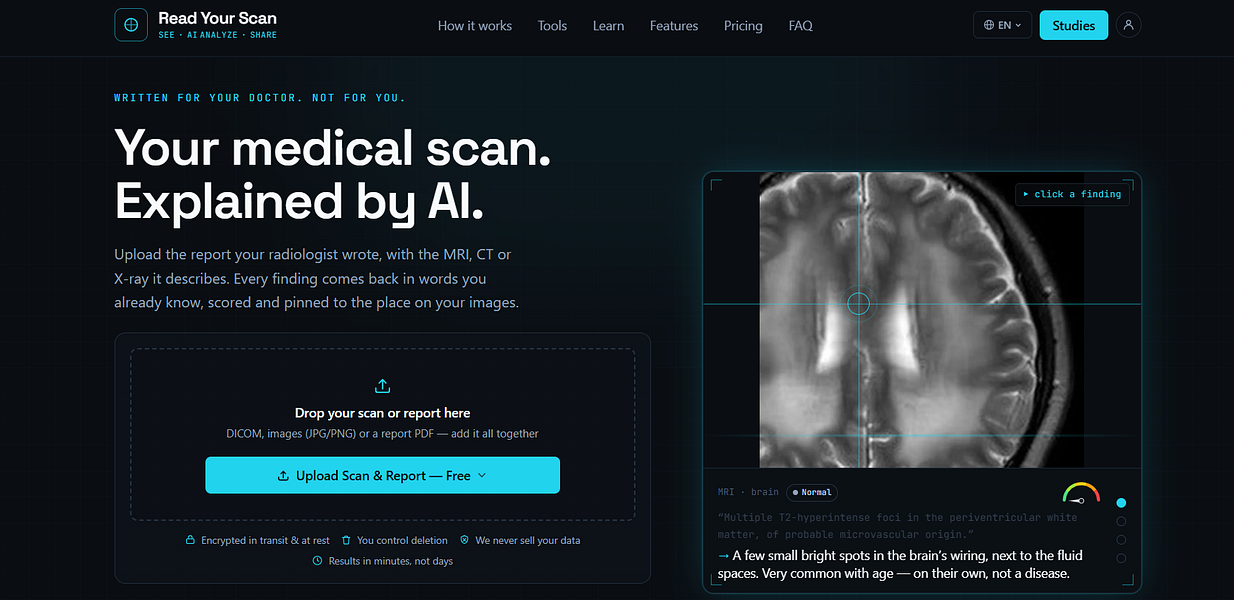 Read Your Scan