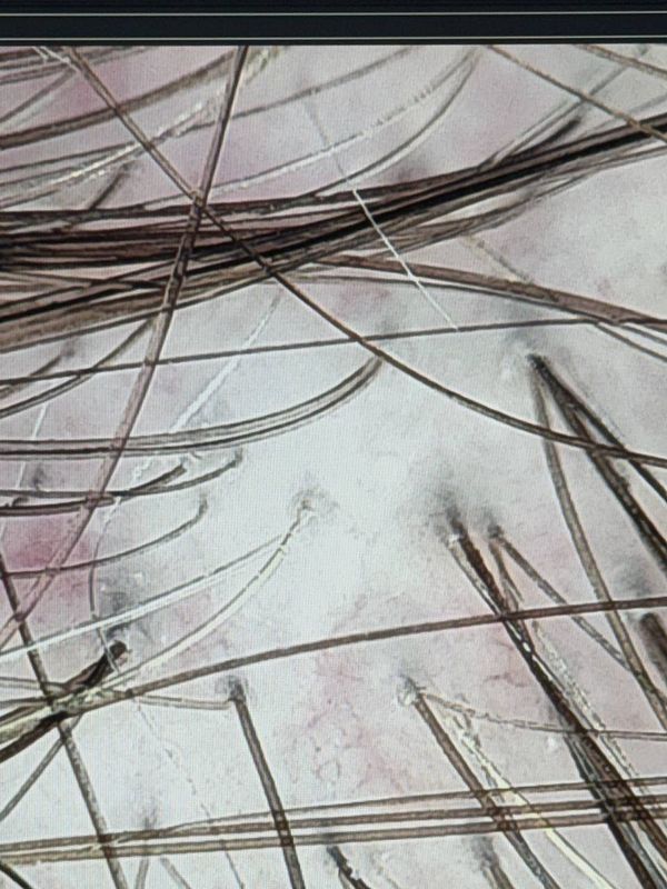 The image displays a close-up view of hair strands against a light background.