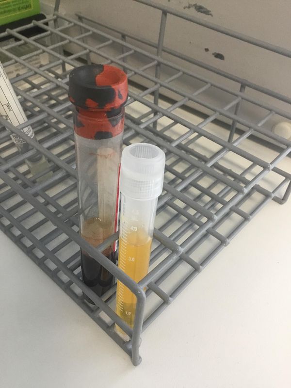 Two test tubes containing serum samples are placed in a gray rack.