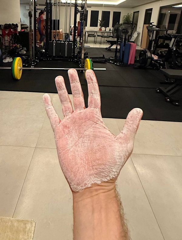 A hand covered in chalk powder is held up in a gym setting.