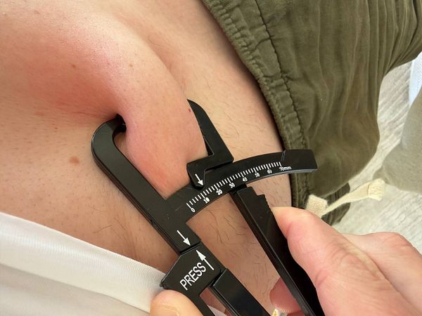 Close-up photo of a hand using a skinfold caliper to measure belly fat thickness on an abdomen.