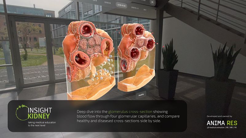 Screenshot of INSIGHT KIDNEY