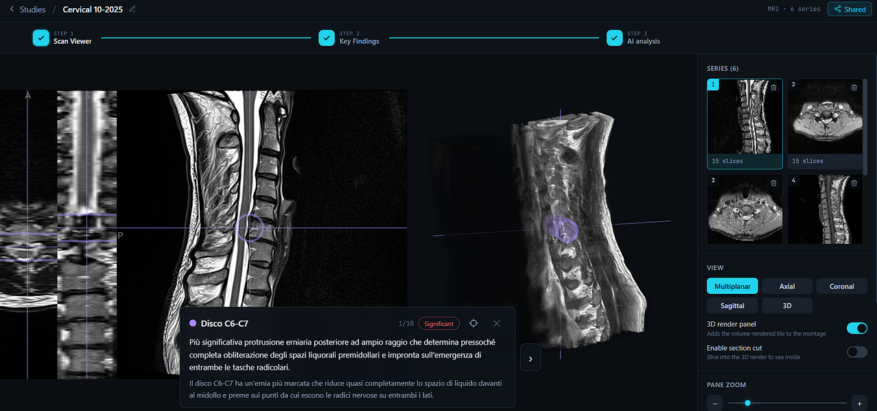 Read Your Scan