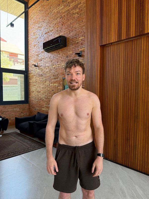 DEXA scan report displaying body composition results including total body fat percentage and lean mass details.