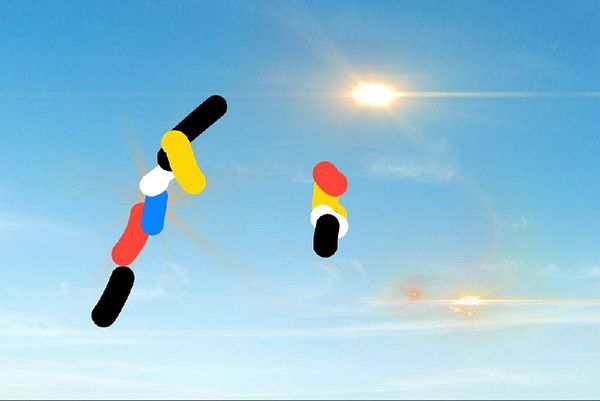 Photograph of the inside of an eye showing detailed structures including the retina with a visible reddish area indicative of a retinal tear or clot.